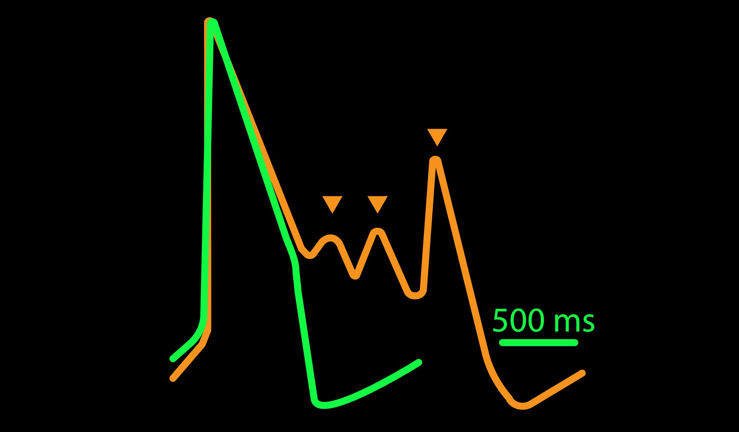 Cardiotoxicity traces